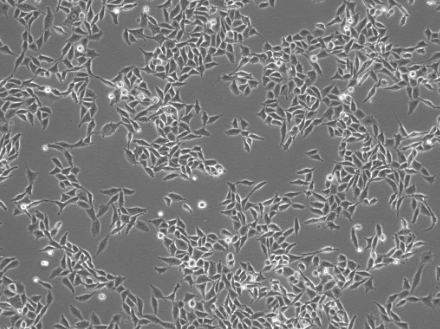 RKO cells (P10, x10)